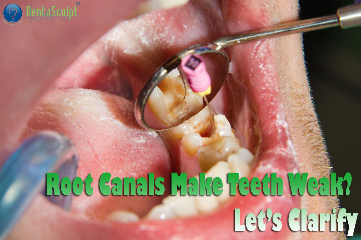 Root Canal Specialist in Memnagar